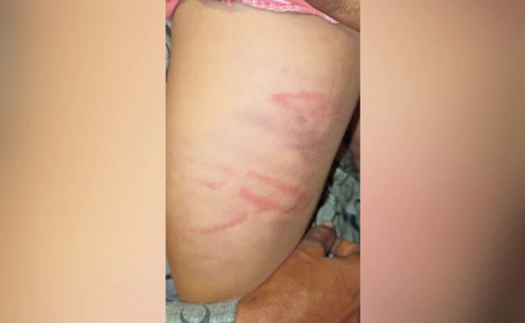 बच्चियों की पिटाई को लेकर एक्शन में दिल्ली महिला आयोग, पुलिस से मांगी रिपोर्ट