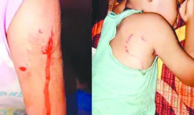 कुत्ते ने 4 बच्चों को नोचा, गुस्साए लोगों ने कुत्ते को मार डाला, उधर कुत्ते के मरने पर पहुंचे एनजीओ के लोगों के साथ बस्ती वालों का जमकर विवाद