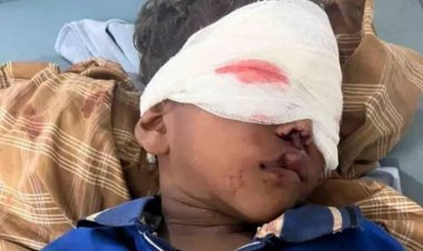 पिता ने चाकू घुसाड़ फोड़ डाली अपने ही बच्चे की दोनों आंखें