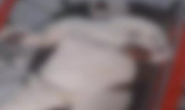 रायपुर  आग में जलती हुए युवती पहुंची रेलवे स्टेशन, हालत गंभीर