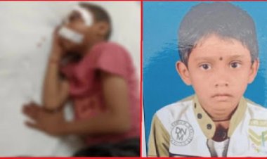 गंभीर हालत में मिला स्कूल के लिए निकला बालक, चोट के कई निशान, एक आंख फोड़ गोंद डालने का प्रयास, हालात नाजुक