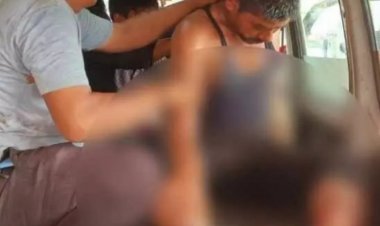 ट्रांसफार्मर पर ड्रॉपआउट फ्यूज चढ़ाने के दौरान गंभीर हादसा, करंट की चपेट में आने से झुलसा ठेका श्रमिक, पैरों से उठने लगा धुआं